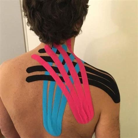 Pin On Ashley Stiven Kinesio Tape