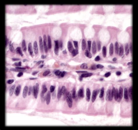 Tissues Histology Photos Epithelial Tissue Simple Simple Columnar