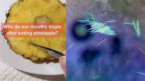 Pineapple Needles Revelation Has People Questioning Whether Theyll