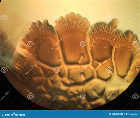 Bacterial Colonies Under The Microscope Beautiful Growth Stock Image