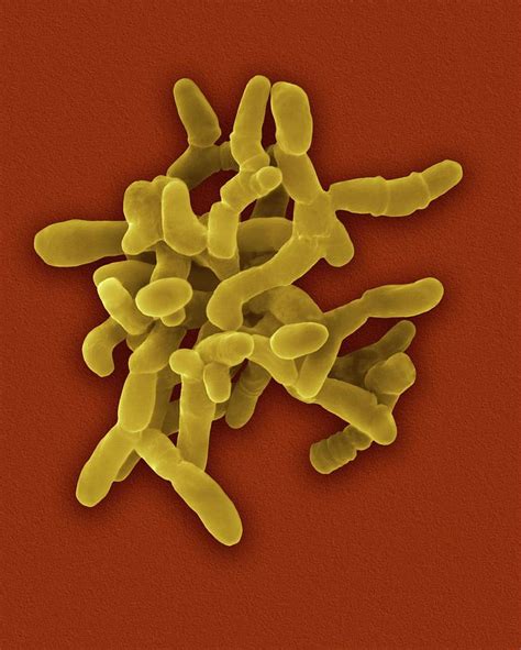 Mycobacterium Paratuberculosis Bacterium Photograph By Dennis Kunkel
