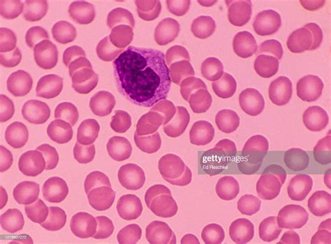 Monocytea White Blood Cell Or Leukocyte That Can Transform Into A