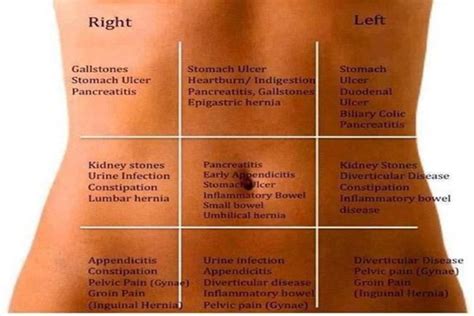 Abdominal Pain Map That Shows What Could Be The Cause Of