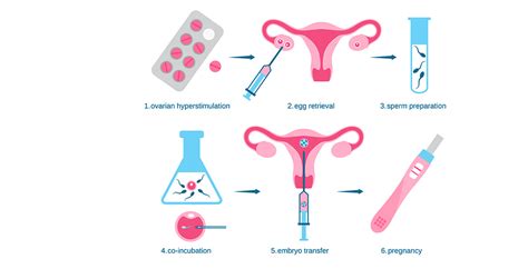 Steps Involved In The Process Of In Vitro Fertilisation IVF Indira IVF