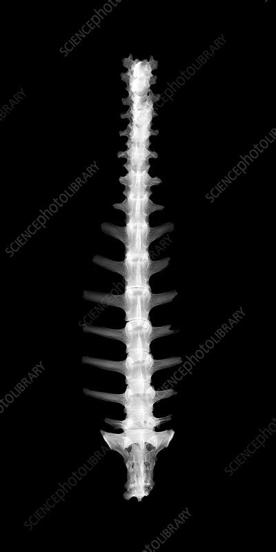 Sheep Spine X Ray Stock Image F0310100 Science Photo Library