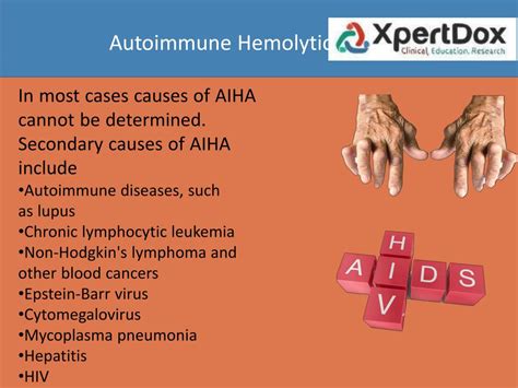 Ppt Autoimmune Hemolytic Anemia Powerpoint Presentation Free