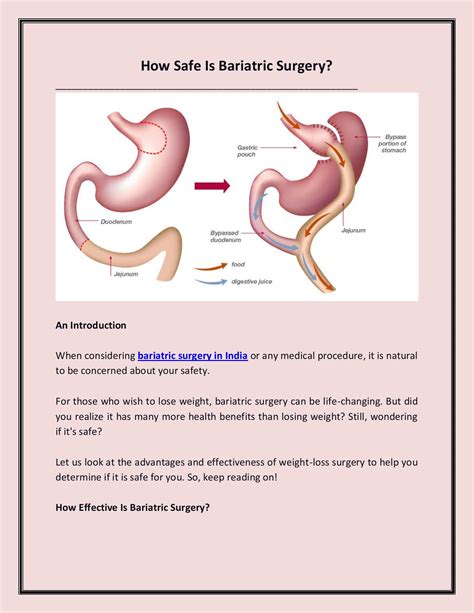How Safe Is Bariatric Surgery Mufamedi Tourism Page 1 Flip Pdf