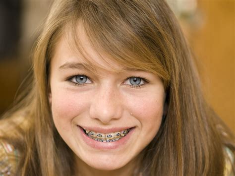 Close Up Smiling Girl With Braces Hardy Pediatric Dentistry