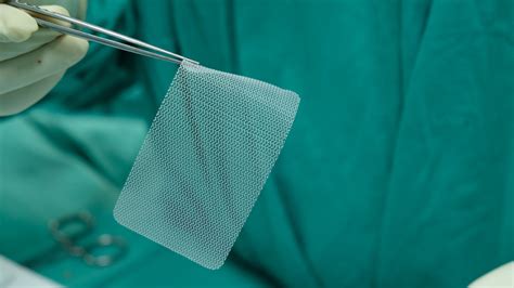 Also for patients suffering from chronic mesh pain, we offer mesh removals. Inguinal Hernia | NIDDK
