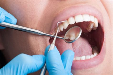 Periodontal Scaling And Root Planing Dental Clinic In Ottawa On Kent