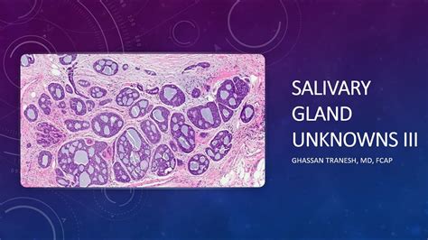 Salivary Gland Pathology Iii With Dr Tranesh Youtube
