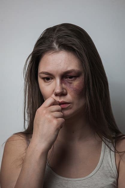 Premium Photo Domestic Violence Abuse Woman With Bruise On The Face