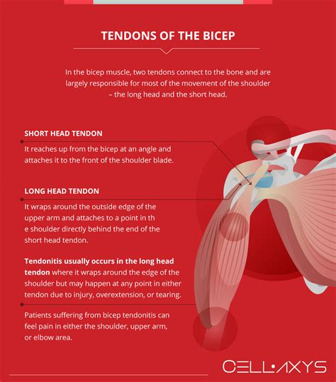 Bicep Tendonitis Shoulder Pain And Treatment Cellaxys