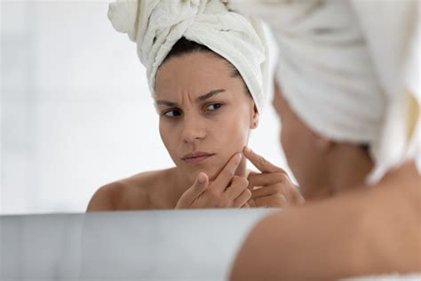 Creating A Skincare Routine For Acne Prone Skin The Aesthetic Center By Medical Associates