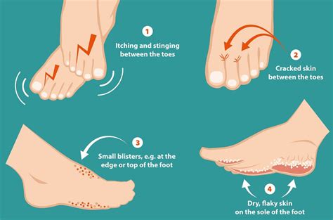 The Most Common Foot Problems And How A Podiatrist Can Help Yoga Brisbane