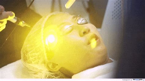 Pro Yellow Laser Treatment Your Solution To Keep Epidermal