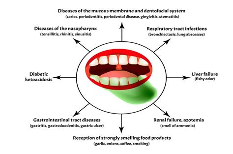 halitosis bad breath or oral malodor focus dentistry