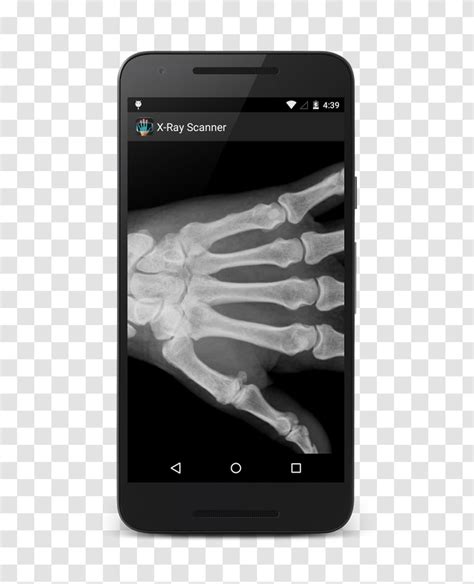 Check spelling or type a new query. How To Xray Photos On Android - Download Free Xray Camera Android Apps Indonesian Mobile / Free ...