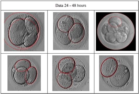 Arcpso Result On Multi Embryo Detection Download Scientific Diagram