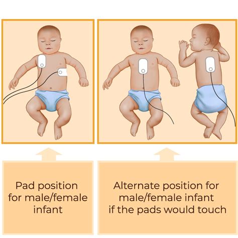 Cpr For Infants Up To 12 Months Step By Step Guide