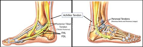 Do You Have An Ankle Tendon Tear Most Dont Need Surgery