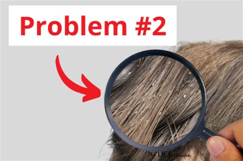 How To Check Your Own Self For Lice The 4 Head Lice Facts That Every