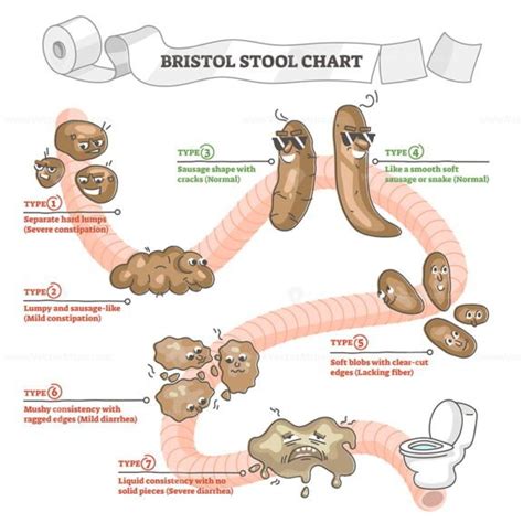 Bristol Stool Chart 7 Types Simple High Resolution Image