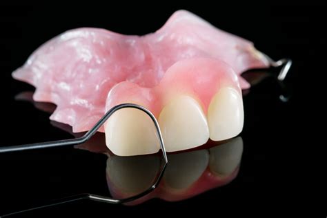 Partial Dentures For Front Teeth What Is A Partial Denture My Xxx Hot