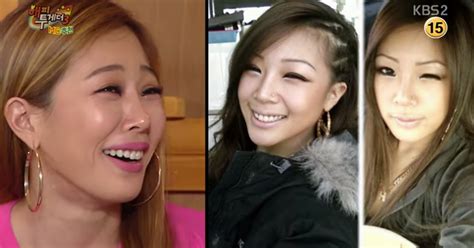 Jessi Admits Undergoing Plastic Surgery On Happy Together 3