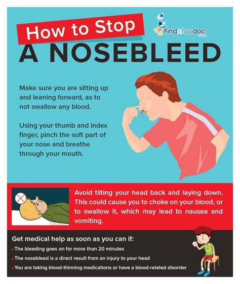 How To Stop A Nose Bleed Infographic With Images Nose Bleeds