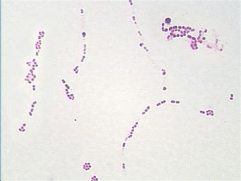 The Gram Positive Cocci Part Ii Streptococcus And Enterococcus