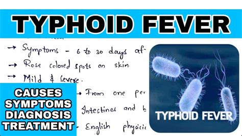 Typhoid Fever Salmonella Typhi Causes Symptoms Diagnosis