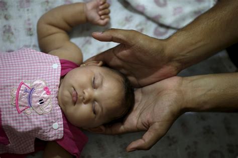 How Does Zika Virus Shrink A Babys Brain And Other Faqs Pbs Newshour