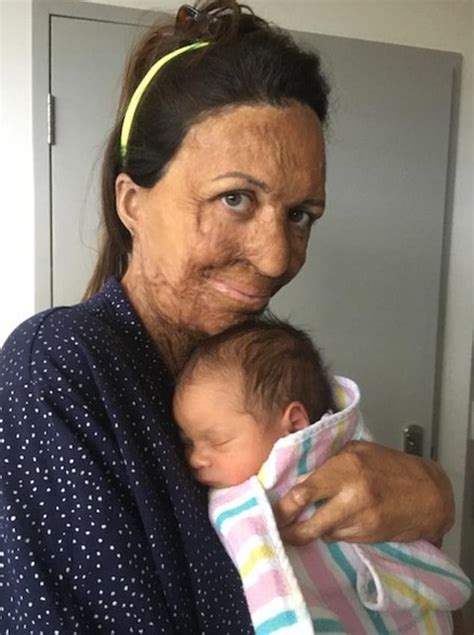 Turia Pitt Shares Photo Breastfeeding Son Hakavai Daily Mail Online