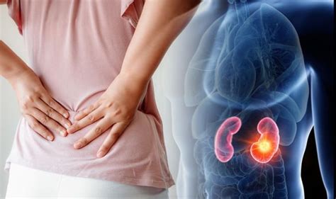 A variety of other internal conditions may also cause low back pain concentrated on the right side, so it is important to be aware of one's symptoms when consulting with a doctor to obtain an accurate diagnosis and effectively plan treatments. Lower back pain: The signs your back pain could be caused be kidney stones | Express.co.uk