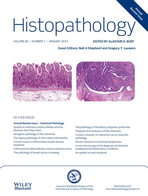 An Update On Anal Neoplasia Fléjou 2015 Histopathology Wiley