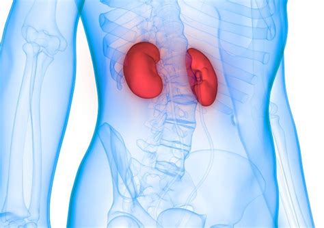 Kidney cancer is a cancer that starts in the kidneys 1). World Kidney Day: What are the signs and symptoms of ...