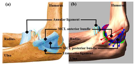 Elbow Medial Ulnar Collateral Ligament Injuries Ucl I Vrogue Co