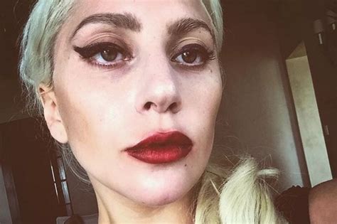 Lady Gaga Reveals She Suffers From Ptsd Dazed