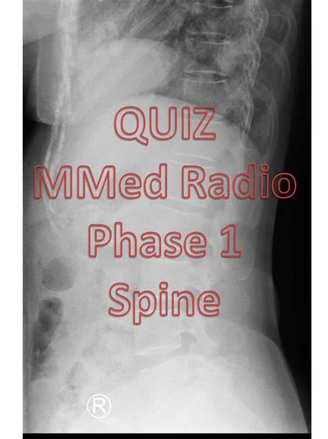 Quiz 6 Radiology Cases