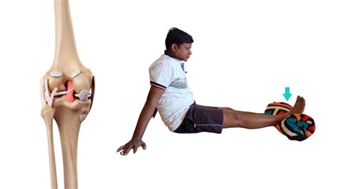 Ligament Injury Of Knee Follow These 7 Easy Exercises For Quick Healing