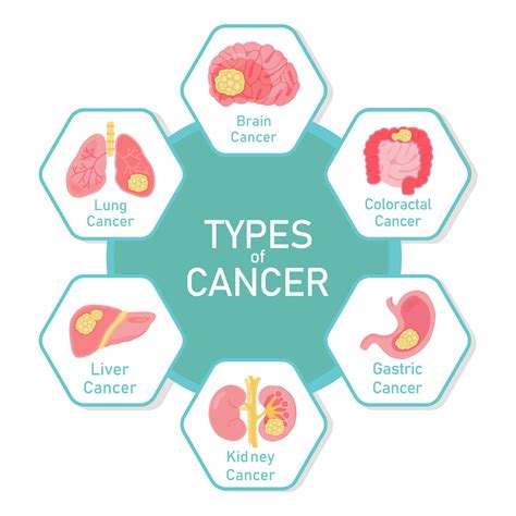Types Of Cancer Diagram Design 1340505 Vector Art At Vecteezy