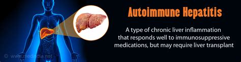 Autoimmune Hepatitis Causes Types Symptoms Complications