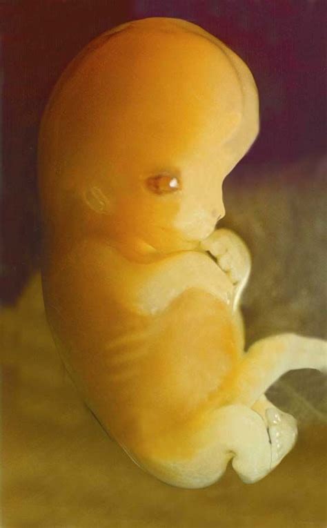 1 Unborn Baby 7 Weeks This Is Exactly What My Baby Looked Like When