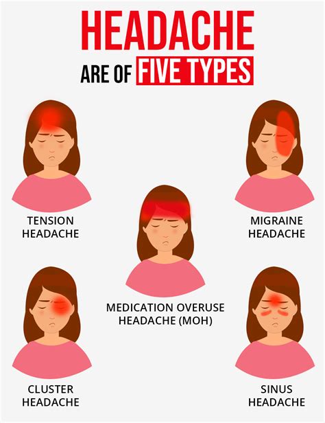Headaches Types And Symptoms Chart My Xxx Hot Girl