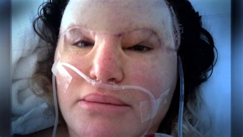 Why Are Eyes Taped Shut During Surgery Health News Website