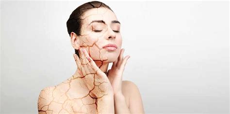 Dry Skin Causes And Management