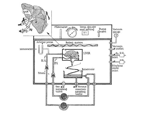 The Official Dr Thomas E Starzl Web Site Surgical Innovations