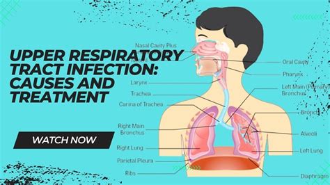 Upper Respiratory Tract Infection Causes And Treatment Youtube