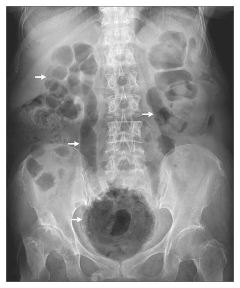 Abdominal Radiographic Anatomy Wikiradiography